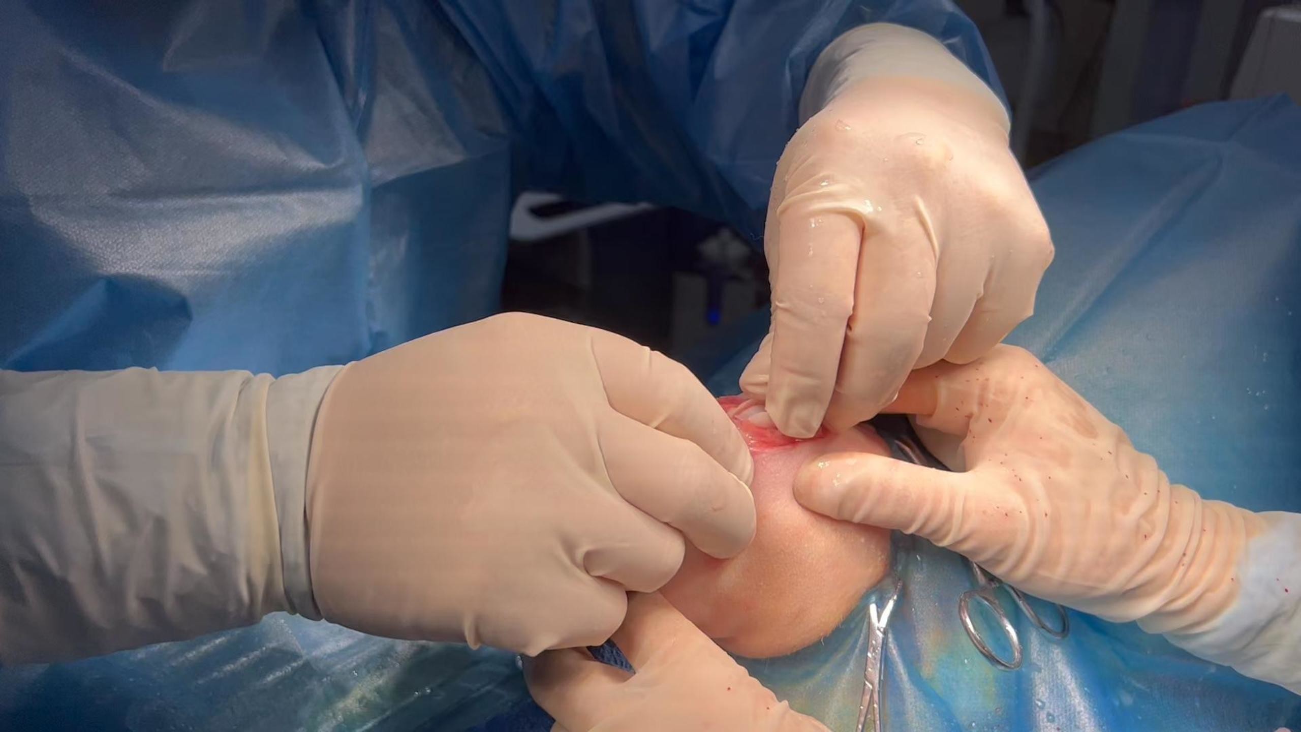 Latest company case about Dr Shi Patellar Luxation Repair Surgery in a Dog | Surgical Procedures