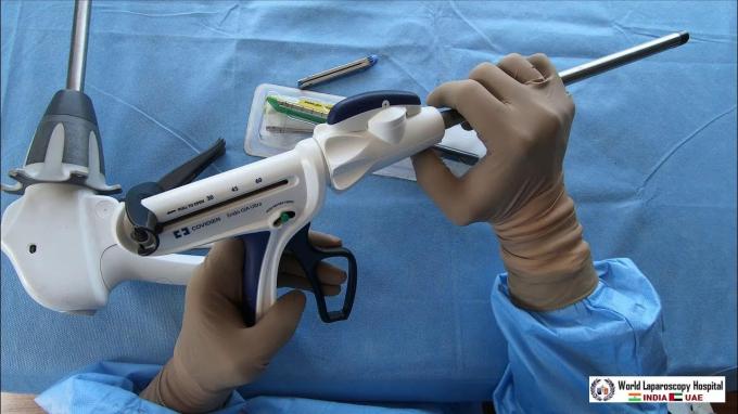 latest company news about What is a Surgical Linner Cutter Stapler? | Surgsci  0