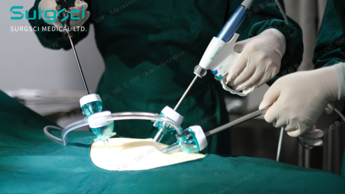 latest company news about Places for Trocar Incision | SurgSci  0