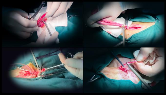 Laparoscope Surgery Ultrasonic Scalpel System Hemostasis for Veterinary Use 6