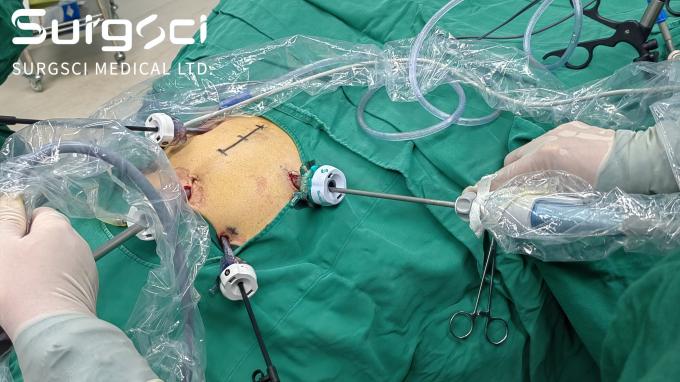 latest company news about Become Our Distributor in Your Country | SurgSci 0