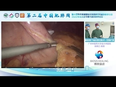 How Ultrasonic Scalpel Works