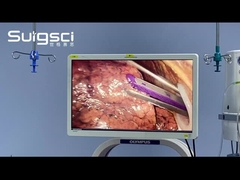 Clinical Application of the Surgsci Endo Cutter Stapler in Surgery